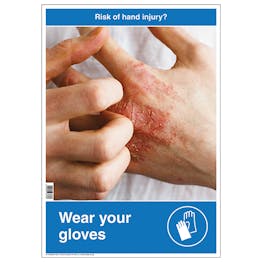 Risk Of Hand Injury Poster