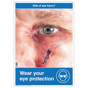 Risk Of Eye Injury Poster