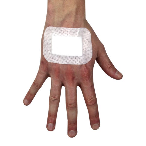 Adhesive Wound Dressings.